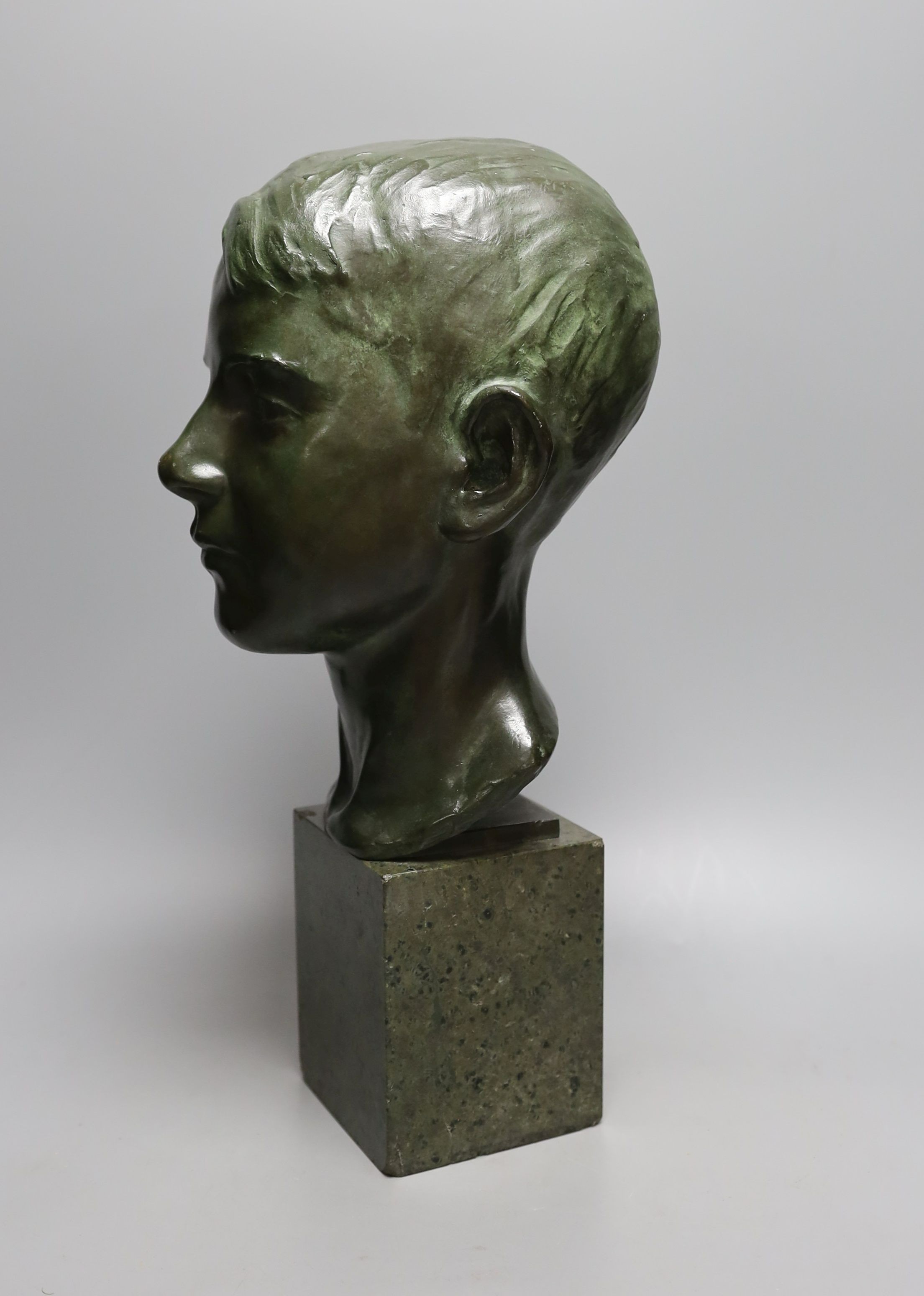 Ida Nelson, a green patinated bronze head of a boy, signed and dated 1926, 42 cms high.